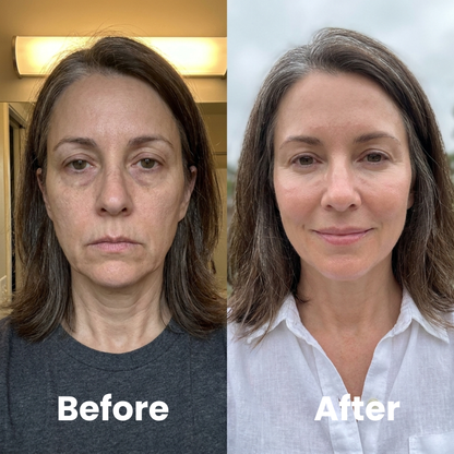Total Restore Serum™