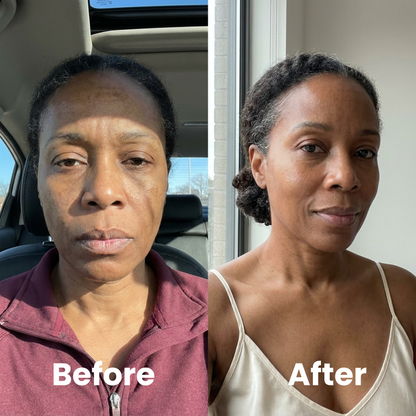 Total Restore Serum™